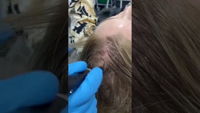 TOP 3 TREATMENTS FOR HAIR GROWTH | DR. MEDISPA