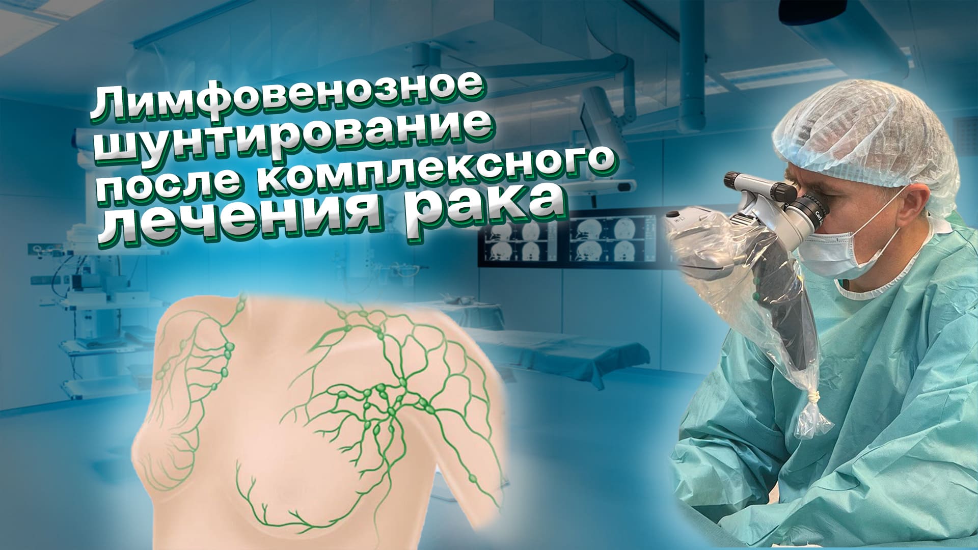 Лимфовенозное шунтирование после комплексного лечения рака в Санкт-Петербурге