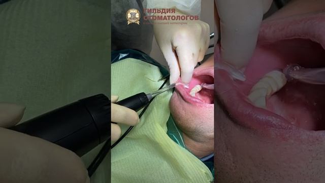 Зачем нужен ирригатор?