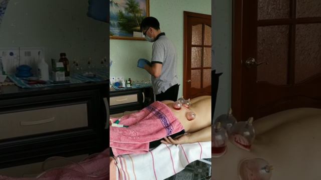 Кровопускание по китайской методике.