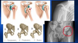 2.07. Массаж при вывихах | Медицинский массаж. Цикл 2