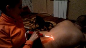 Дарсонваль, большие разгибатели спины.