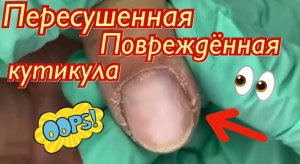 Пересушенная и повреждённая кутикула???⚠️❗️