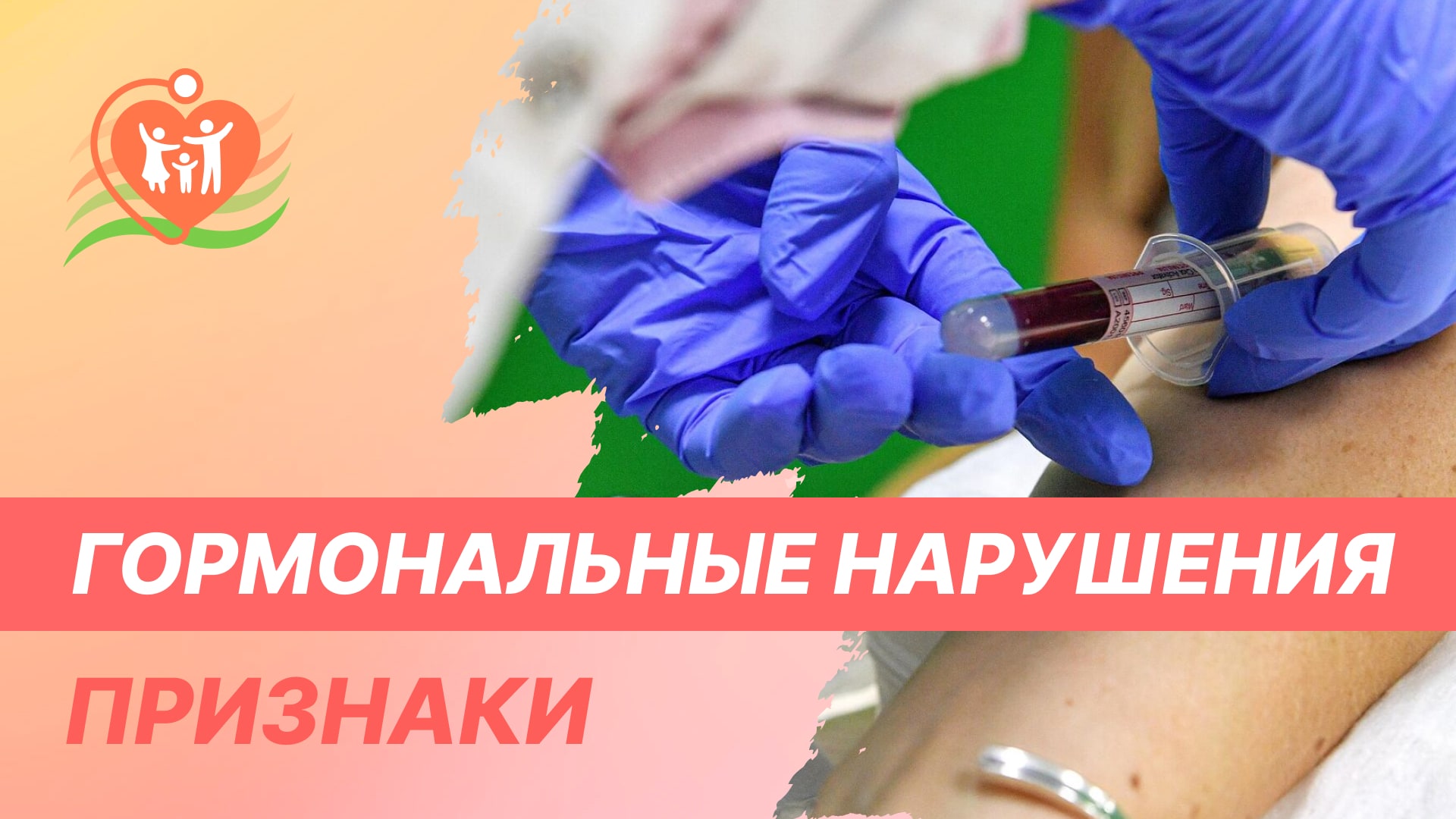 Гормональные нарушения у мужчин