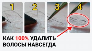 Урок №2. Что такое электроэпиляция? Обучение электроэпиляции в свободном доступе. 80+ уроков