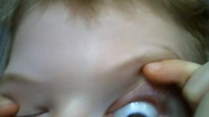 Я вырвал сибе глаз........