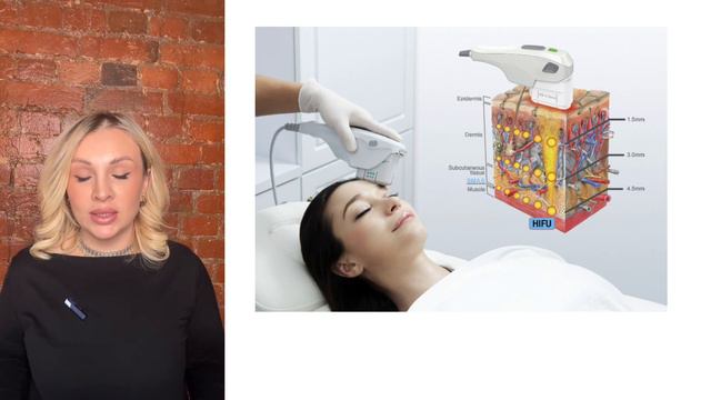 SMAS-лифтинг • разоблачение процедуры • почему я не советую делать SMAS? Мнение косметолога смотреть онлайн