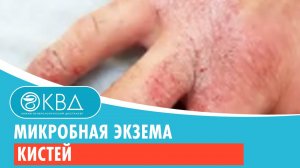 Микробная экзема кистей. Клинический случай №37