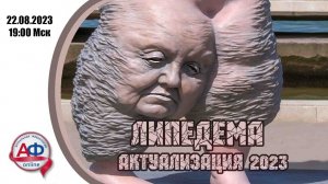 Липедема 2023