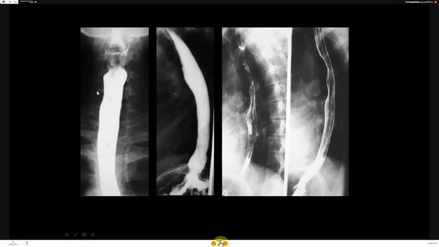 Radiology : contrast studies of GIT смотреть онлайн
