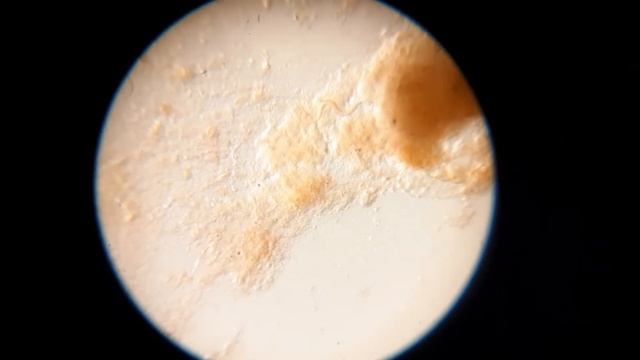 КТО НАХОДИТСЯ ПОД ОБОДКОМ УНИТАЗА смотреть онлайн