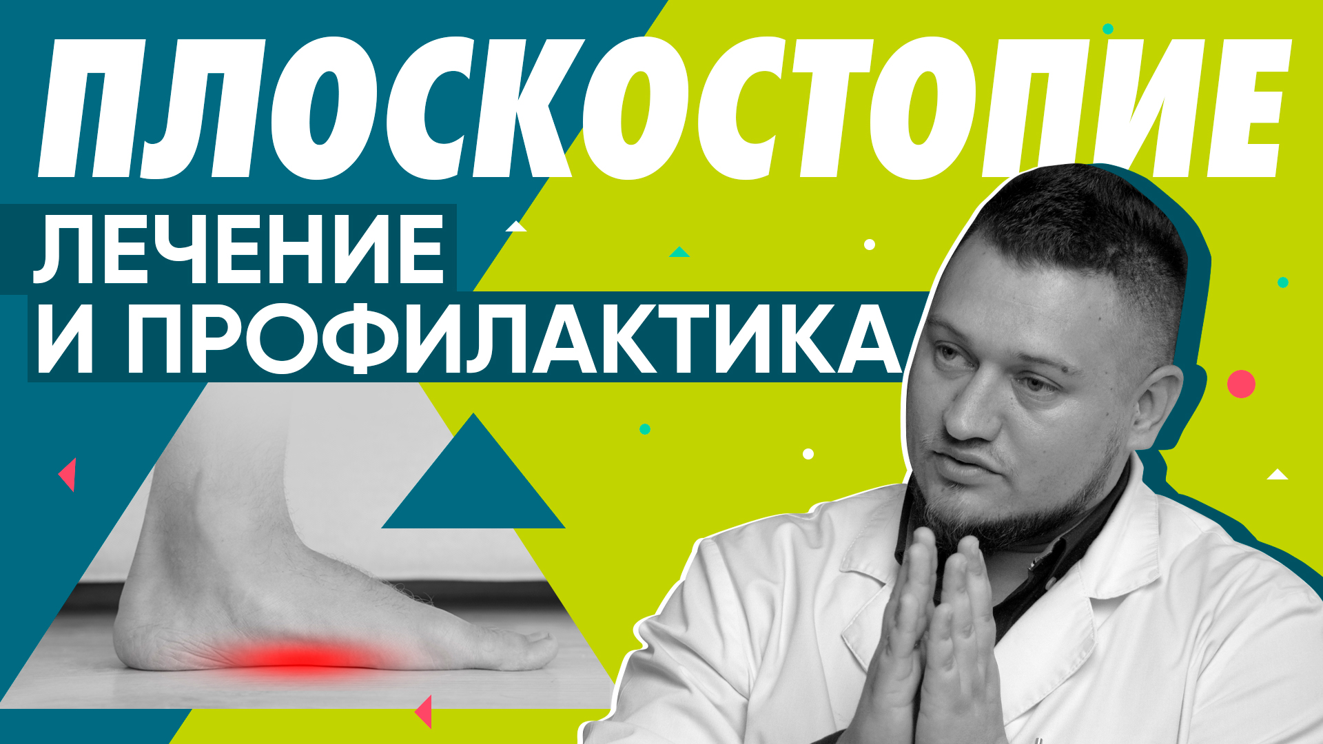 Как лечить плоскостопие? Профилактика плоскостопия, операция | Здоровье ног