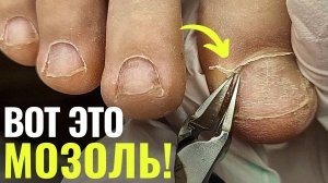 УСТАЛА МУЧАТЬСЯ!😫ПОДРОБНО про ПЕДИКЮР для новичков!