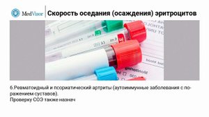 СОЭ в анализе крови: расшифровка, результаты, норма