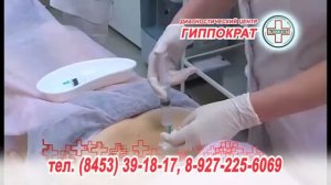 Озонотерапия для суставов и спины