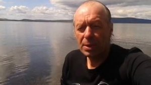 Термические ожоги.Как лечить ожоги.Экстренная помощь.