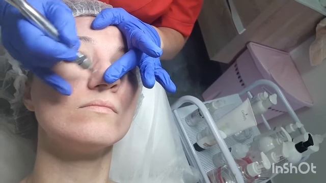 Уход за лицом у косметолога/дермабразия и феруловая кислота.АСМР#шуршание