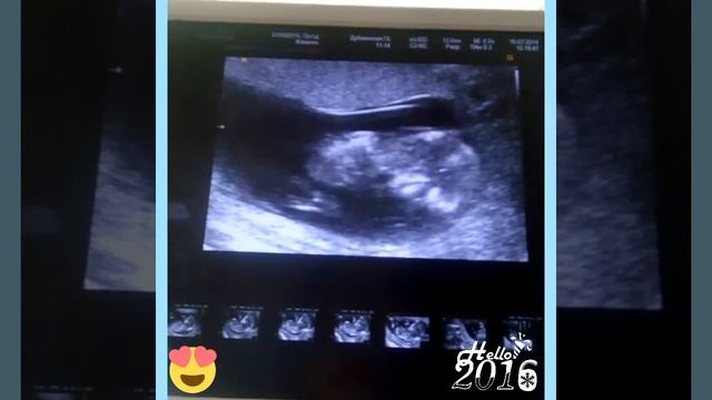 Как шевелиться малыш в животе? 12 недель. смотреть онлайн