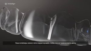 Элайнеры Invisalign в Ростове на Дону