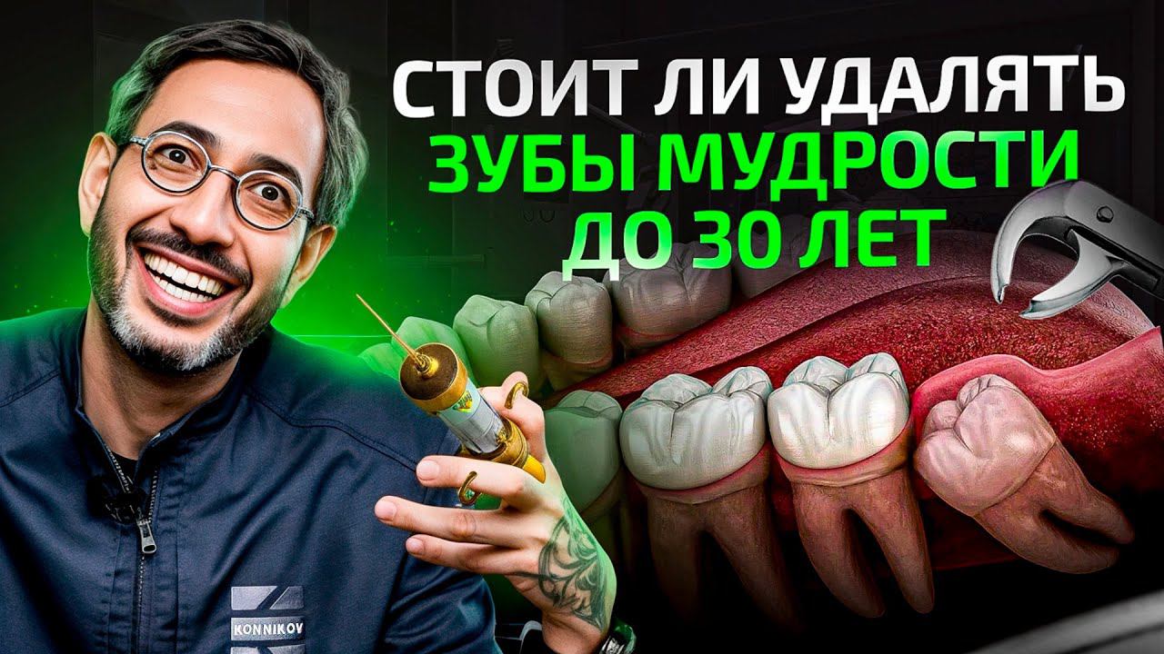 5 причин удалить зубы мудрости до 30 лет. Они тебе пригодятся только в 2 случаях