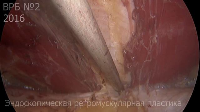 E  -  Milos Operаtion