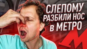 Самый жуткий поход в ресторан! // Вернулся с разбитым носом!