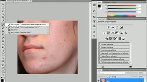 Как удалить прыщи с помощью Photoshop?
