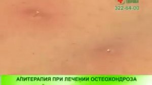 лечение спины пчелами