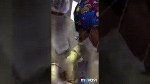 Гемитиреоидэктомия с права ( удаление правой доли щитовидной железы)