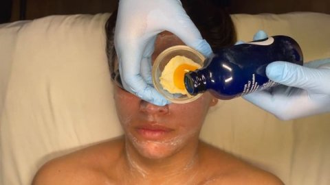 RESURFACING FACIAL FOR TEXTURED OILY COMBINATION SKIN TYPES | IMAGE SIGNATURE FACELIFT TREATMENT