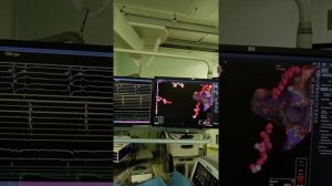 Радиочастотная аблация (РЧА) трепетания предсердий