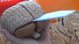 Оболочки головного мозга на препаратах