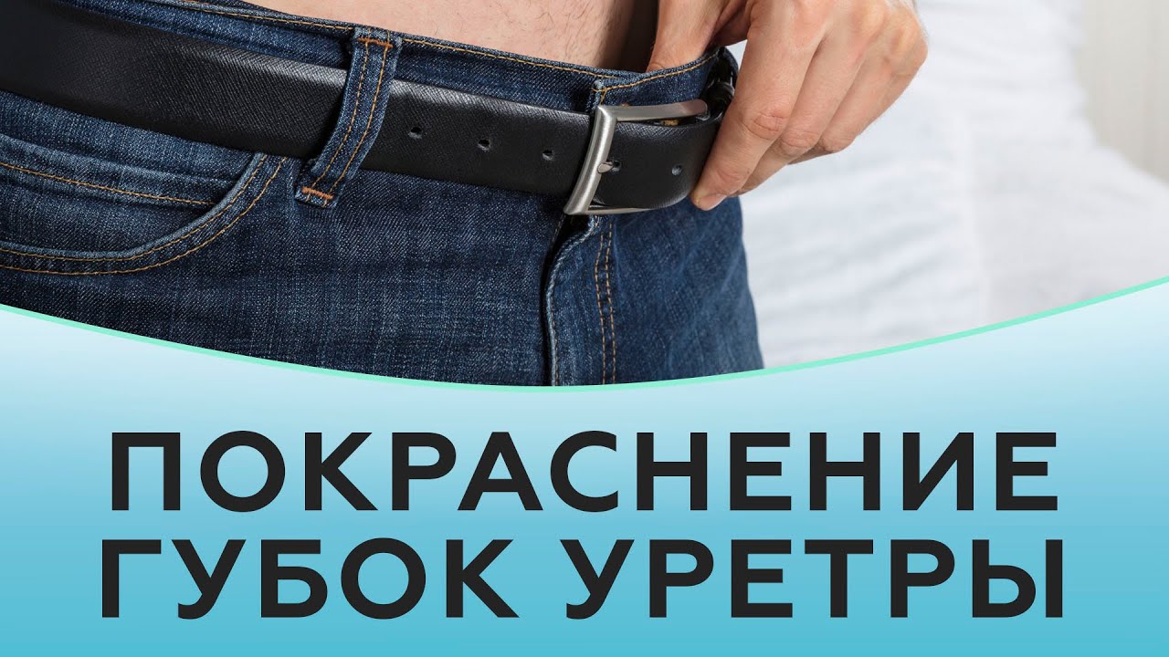 Покраснение уретры у мужчин. Покраснение мочеиспускательного канала. Покраснел мочеиспускательный канал. Краснота в мочеиспускательном канале. Покраснение губок члена.