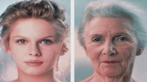 Старые дети (синдром хатчинсона-гилфорда прогерия детей) [Ужасающая действительность]