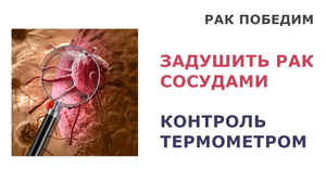 Задушить раковую опухоль сосудами. Контроль с помощью термометра