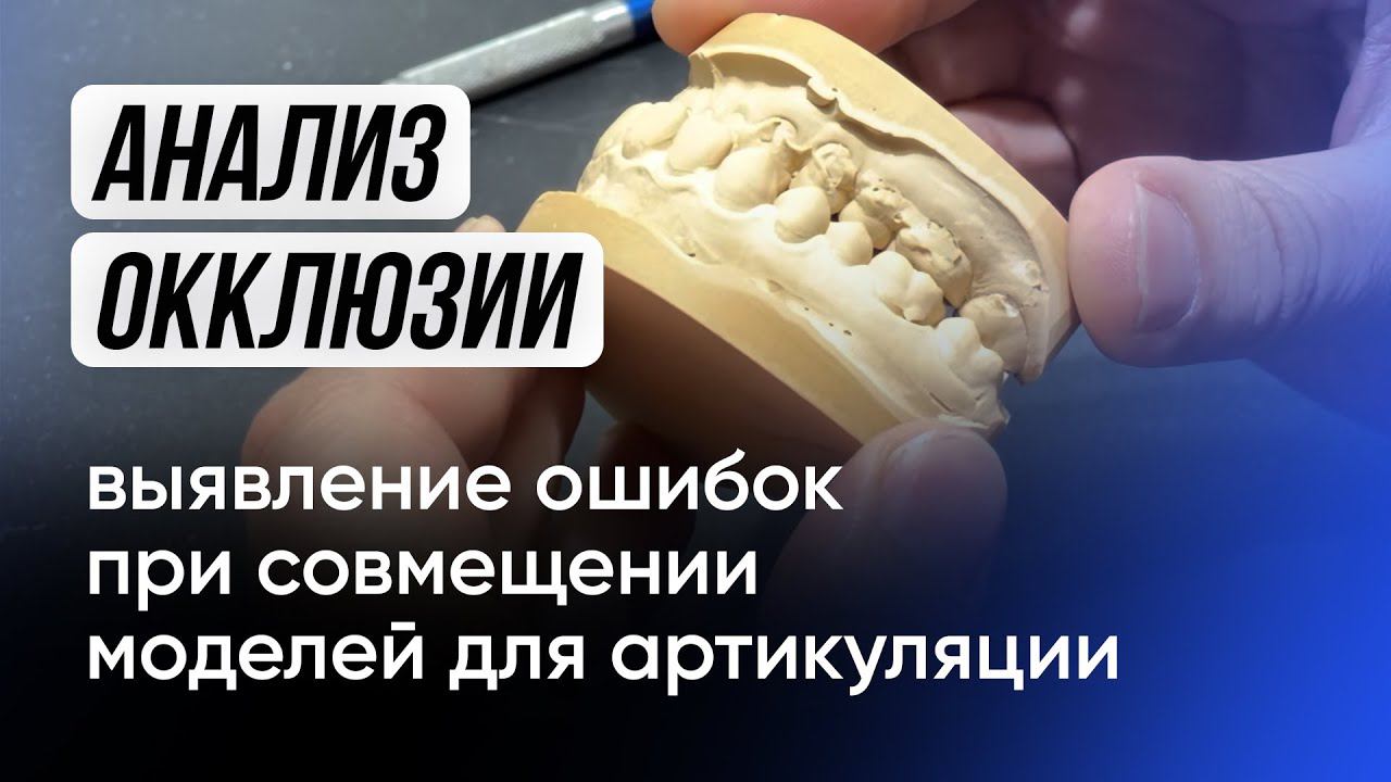 Анализ окклюзии, выявление ошибок при совмещении моделей для артикуляции