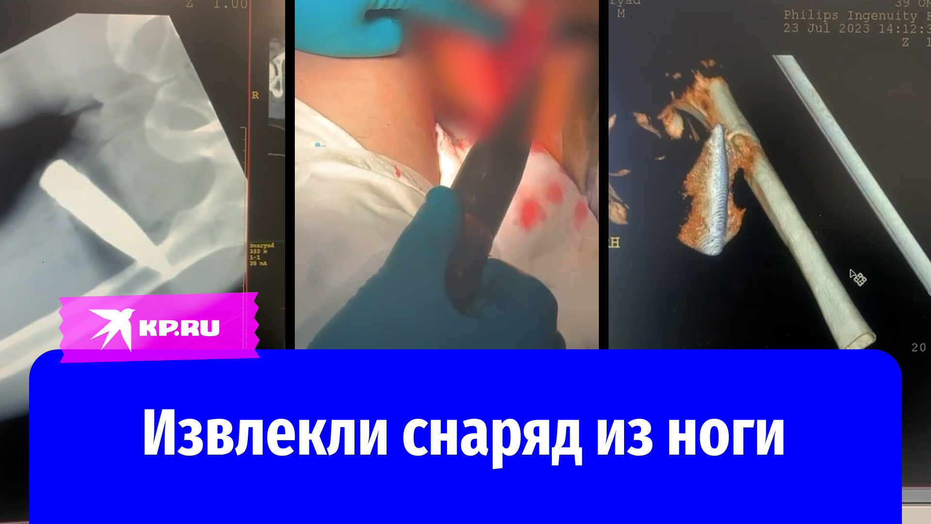 видео достала грудь фото 77