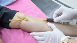 ЧТО ТАКОЕ ПОДАГРА И ЧЕМ ОНА ОПАСНА