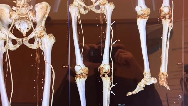 Нормальные герои всегда идут в обход смотреть онлайн