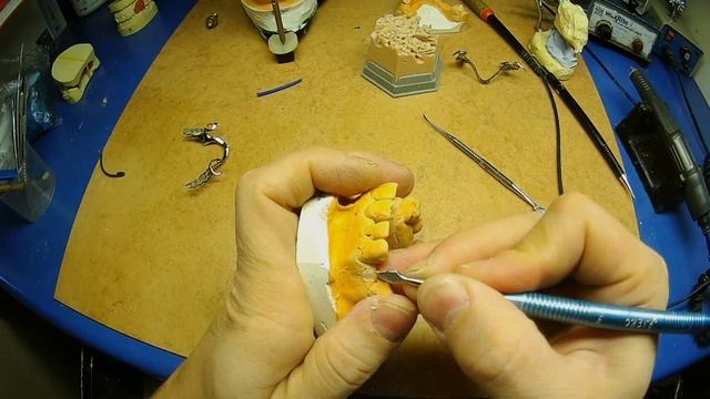Бюгельный каркас. Подготовка модели к дублированию.
