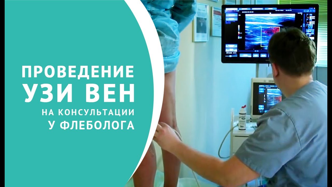 Ультразвуковое исследование вен
