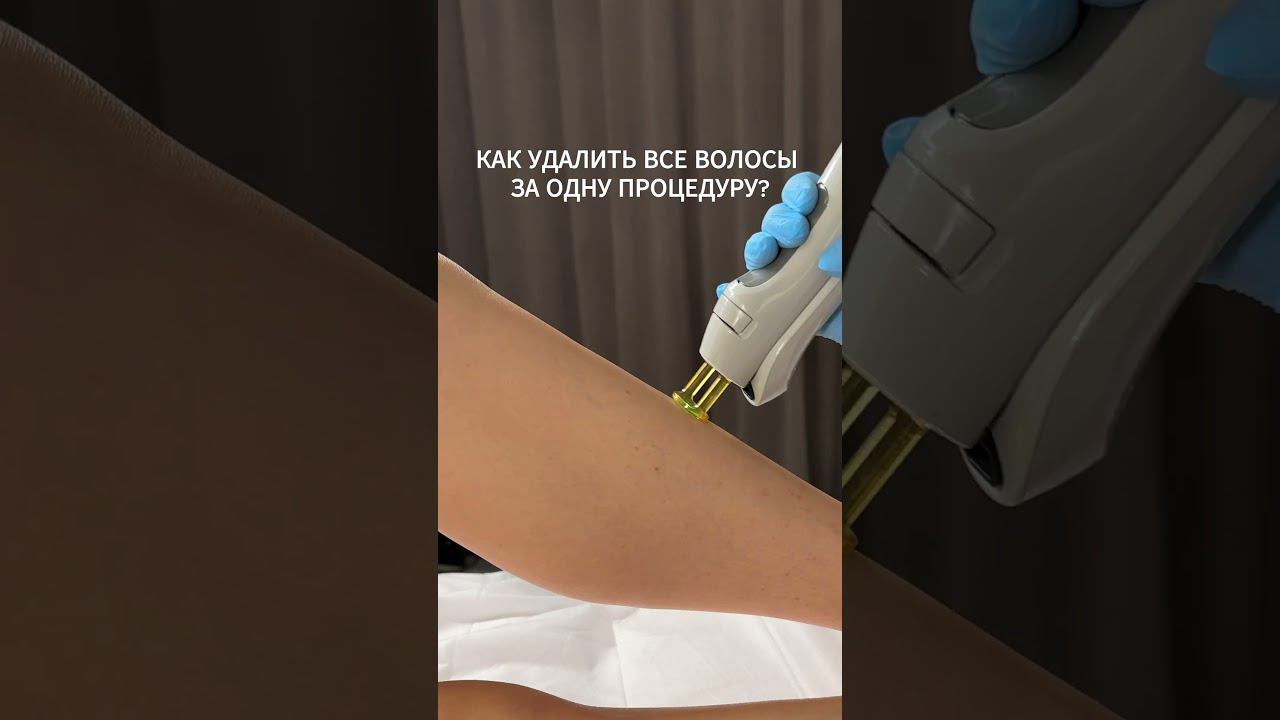 Удалить все волосы за одну процедуру лазерной эпиляции  - нереально! | #лазернаяэпиляция #эпиляция