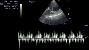 ДКМП Дилатационная кардиомиопатия собак