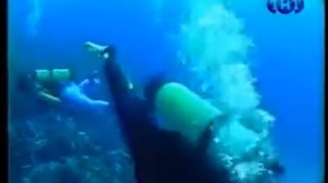 Что такое кессонная болезнь?