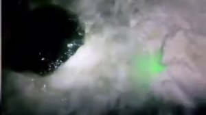 Установка сетей торпедой