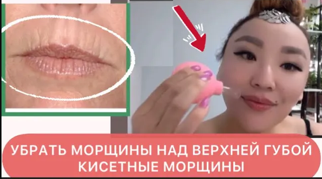 КАК УБРАТЬ МОРЩИНЫ НАД ВЕРХНЕЙ ГУБОЙ ? МОРЩИНЫ ВОКРУГ РТА. ВАКУУМНО БАНОЧНЫЙ МАССАЖ ЛИЦА