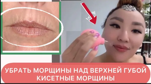 КАК УБРАТЬ МОРЩИНЫ НАД ВЕРХНЕЙ ГУБОЙ ? МОРЩИНЫ ВОКРУГ РТА. ВАКУУМНО БАНОЧНЫЙ МАССАЖ ЛИЦА