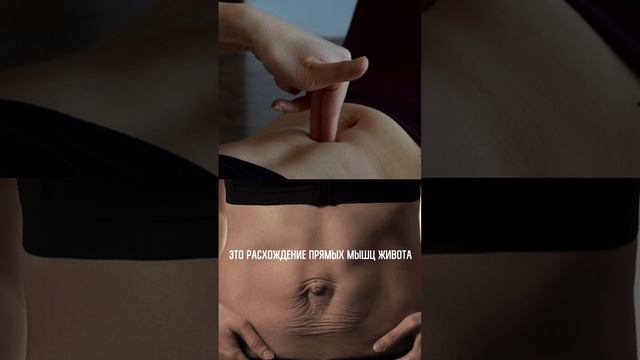 Кому нельзя делать упражнения на пресс смотреть онлайн