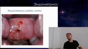 Как делают аборты