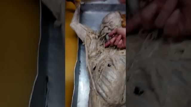 Дорсальний хребетний(1) смотреть онлайн